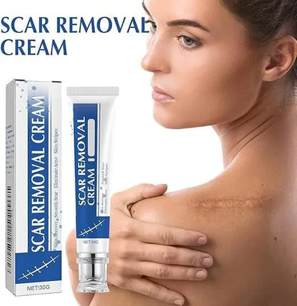 ScarSmooth™- Great for all types of marks
