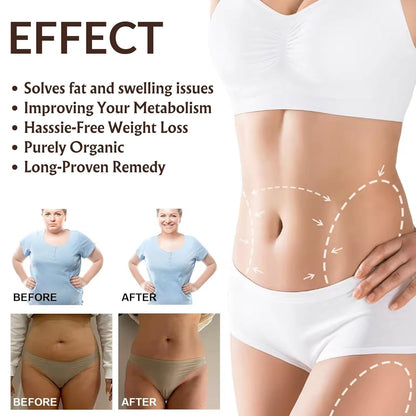 Enhanced Silicone Fusion Body Patch - Silicone Patches For Scars - Prevent and Treat Stretch Marks