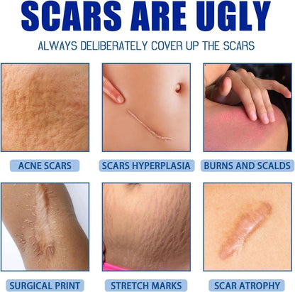 ScarSmooth™- Great for all types of marks