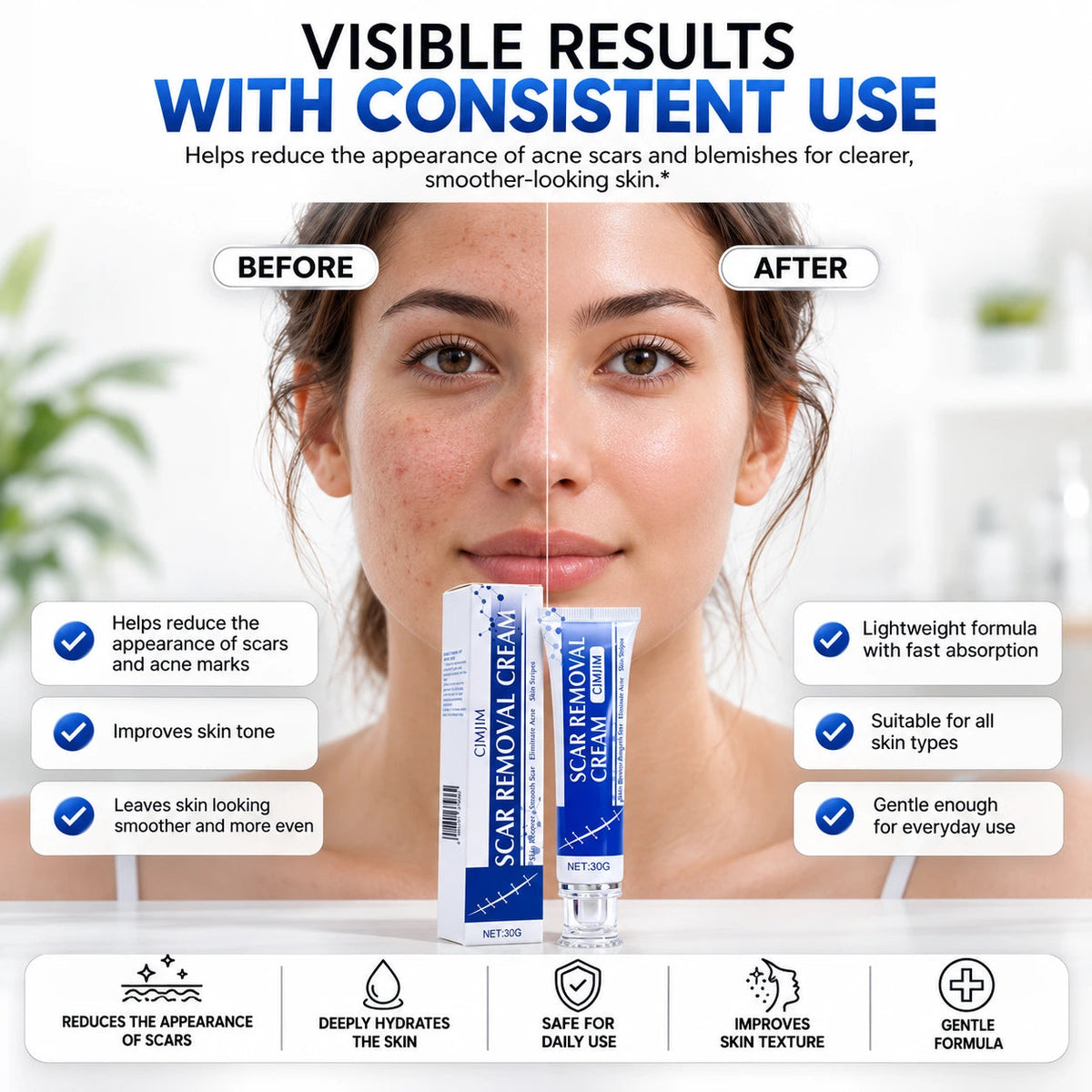 ScarSmooth™- Great for all types of marks