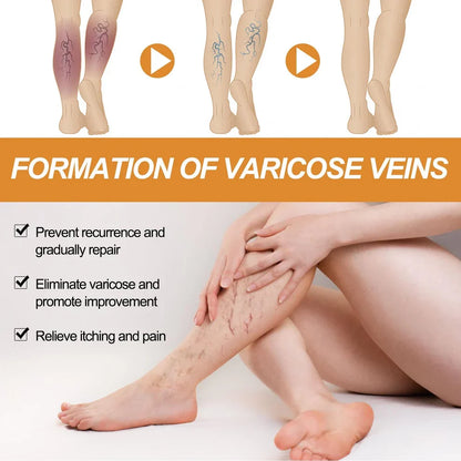 Turmeric Varicose Veins Relief Spray (BUY 1 GET 1 FREE💥 🎁 )