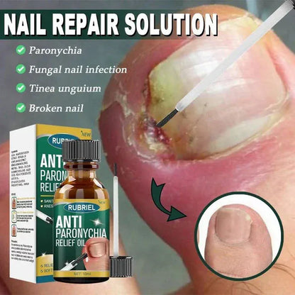 💅Anti-Paronychia Nail Relief Oil 🔥 Buy 1 Get 1 FREE @ Just ₹499! 🔥
