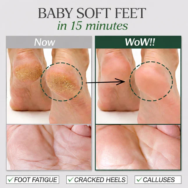 Deep-Cleansing Foot Mask